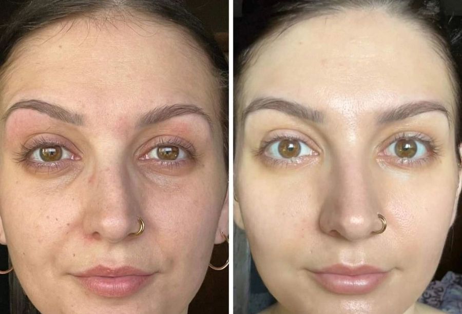 Before / After